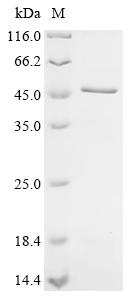 Recombinant Human Melanoma-associated antigen 3 (MAGEA3)