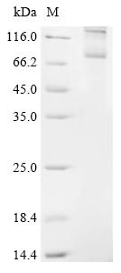 Recombinant Rat Follicle-stimulating hormone receptor (Fshr)