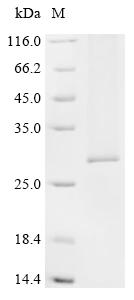 Recombinant Human Aquaporin-2 (AQP2)