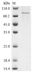 Recombinant Human Protein-arginine deiminase type-2 (PADI2)