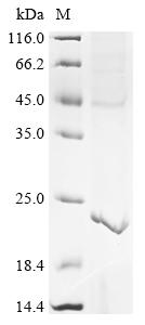 Recombinant Birmingham IncP-alpha plasmid Upf32.8 protein (upf32.8)