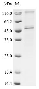 Recombinant Human Sarcoplasmic/endoplasmic reticulum calcium ATPase 1 (ATP2A1), partial