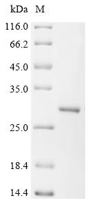 Recombinant Human ATP-dependent DNA helicase Q5 (RECQL5), partial