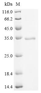 Recombinant Mouse Sialate O-acetylesterase (Siae)