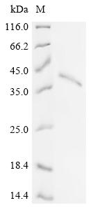 Recombinant Puumala virus Envelope glycoprotein (GP), partial