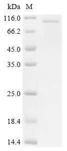 Recombinant Potato leafroll virus Protein P1-P2, partial