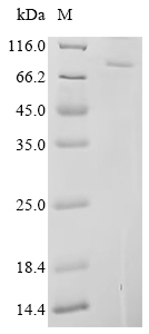 Recombinant Human Origin recognition complex subunit 1 (ORC1), partial