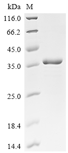 Recombinant Human herpesvirus 6B Large structural phosphoprotein (U11), partial