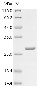 Recombinant Human Glycodelin (PAEP)