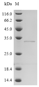 Recombinant Human Transmembrane 9 superfamily member 1 (TM9SF1), partial