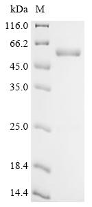 Recombinant Human Aurora kinase A (AURKA)