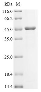 Recombinant Mouse Matrix metalloproteinase-21 (Mmp21)