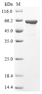 Recombinant Mouse RAC-beta serine/threonine-protein kinase (Akt2)