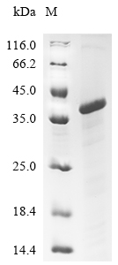 Recombinant Chicken Low-density lipoprotein receptor-related protein 1 (LRP1), partial