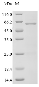 Recombinant Human Gasdermin-D (GSDMD)