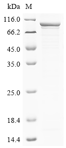 Recombinant Influenza A virus Polymerase basic protein 2 (PB2)