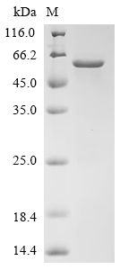 Recombinant Human Hepatic sodium/bile acid cotransporter (SLC10A1), partial, Biotinylated