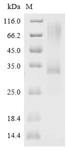 Recombinant Human Sclerostin (SOST), Biotinylated