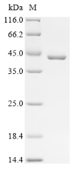 Recombinant Mouse Spectrin beta chain, non-erythrocytic 1 (Sptbn1), partial