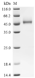 Recombinant Human Dipeptidase 1 (DPEP1)