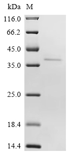 Recombinant Human Kinesin-like protein KIFC2 (KIFC2), partial