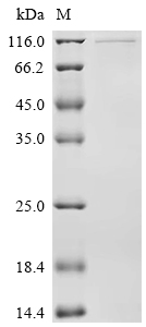 Recombinant Human Origin recognition complex subunit 1 (ORC1)