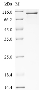 Recombinant Human Elongation factor 2 (EEF2)