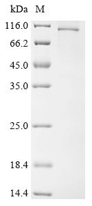 Recombinant Human Schlafen family member 11 (SLFN11)