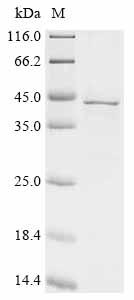 Recombinant Human Paraneoplastic antigen Ma2 (PNMA2), partial