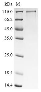 Recombinant Human Cancer-associated gene 1 protein (CAGE1)