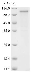 Recombinant Human PR domain zinc finger protein 8 (PRDM8)