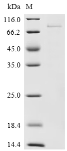 Recombinant Rat Serine/threonine-protein kinase Chk1 (Chek1)