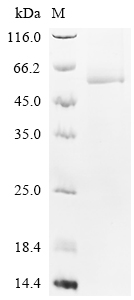 Recombinant Rat Serine/threonine-protein kinase Chk1 (Chek1)