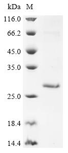Recombinant Human Ropporin-1A (ROPN1)