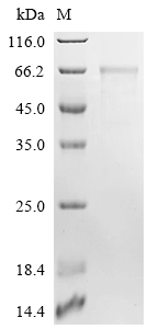 Recombinant AKV murine leukemia virus Envelope glycoprotein (env), partial