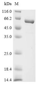 Recombinant Human Inosine-5’-monophosphate dehydrogenase 2 (IMPDH2), partial