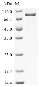Recombinant Human Zinc finger protein 74 (ZNF74)