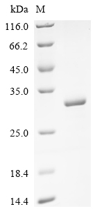 Recombinant Human E3 ubiquitin-protein ligase RNF182 (RNF182), partial