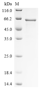 Recombinant Human MAP kinase-interacting serine/threonine-protein kinase 1 (MKNK1)