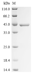 Recombinant Human Arginase-1 (ARG1)