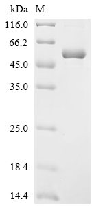 Recombinant Human Cyclin-dependent kinase 15 (CDK15)