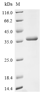 Recombinant Escherichia coli O6:H1 Uncharacterized deoxyribonuclease YcfH (ycfH)
