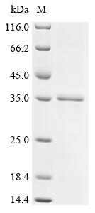 Recombinant Actinidia deliciosa Actinidain