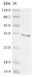 Recombinant Mouse Dickkopf-related protein 2 (Dkk2)