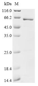 Recombinant Human Microtubule-associated tyrosine carboxypeptidase 1 (MATCAP1)