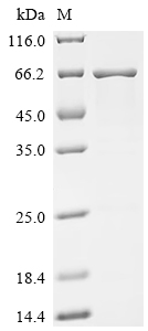 Recombinant Human Carboxylesterase 3 (CES3)
