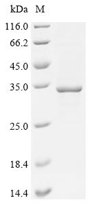 Recombinant Bovine Isoamyl acetate-hydrolyzing esterase 1 homolog (IAH1)