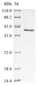 Recombinant Human Inorganic pyrophosphatase 2, mitochondrial (PPA2)