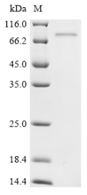 Recombinant Human CCNA2&CDK2 Heterodimer Protein