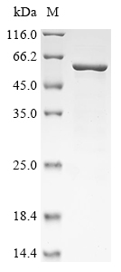 Recombinant Human Dyslexia-associated protein KIAA0319-like protein (KIAA0319L), partial